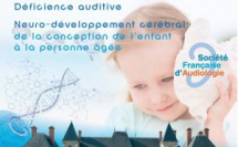 SFA 2017 - CONGRES D'AUDIOLOGIE - PARIS (303 PERSONNES)